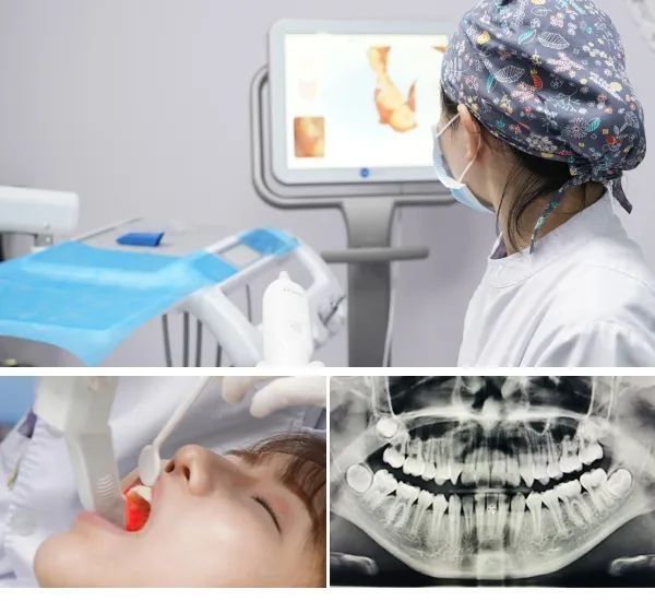 牙齿矫正面诊医生时需要注意问哪些问题呢