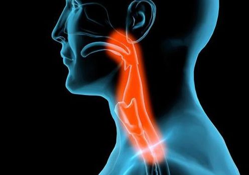 急性咽喉炎一般几天能好 5c6d1e6580ceff83ac3c586ce7ecc7cb41e5c91d.jpg