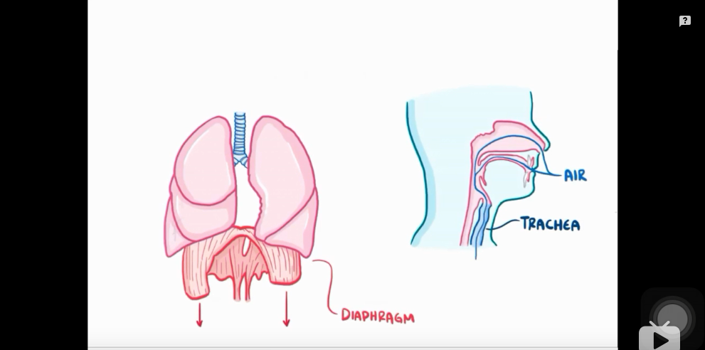 支气管扩张(bronchiectasis)