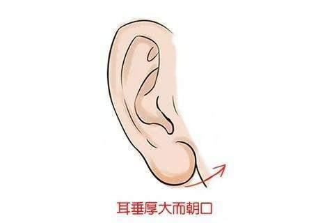 余文林解答:关于耳垂整形术怎么做?
