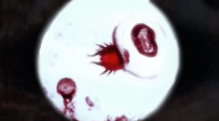 黑光病毒(blacklight virus)