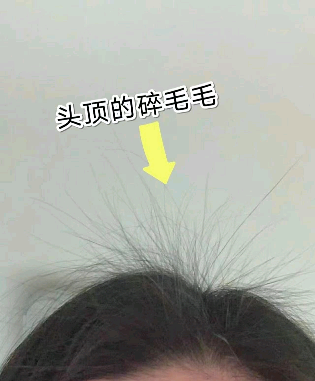 怎么缓解头发脱落 66f56e7d31bae50889e4450c9c13634d3a1a246a.jpg
