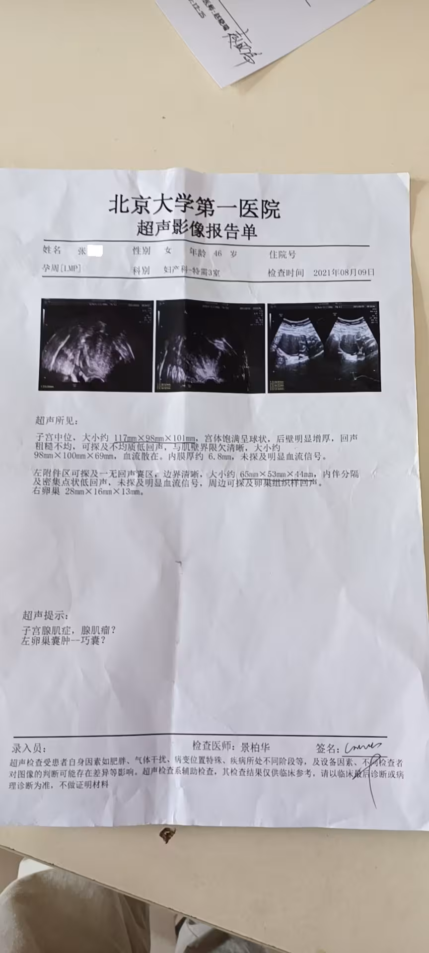 治疗子宫腺肌症不按常规出牌反而效果好?谈中药奇方汤剂治疗原理