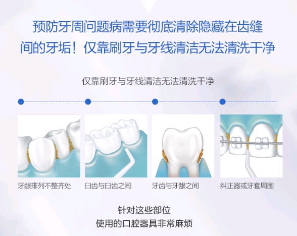 怎么快速止牙出血 6dc7a975b50672ff286bc2ab98ba476e3b04c31a.jpg