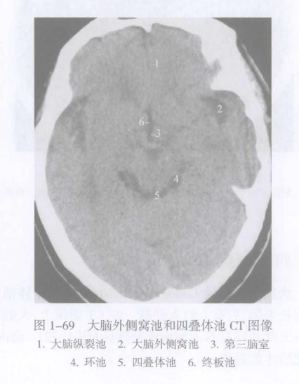 帆间池