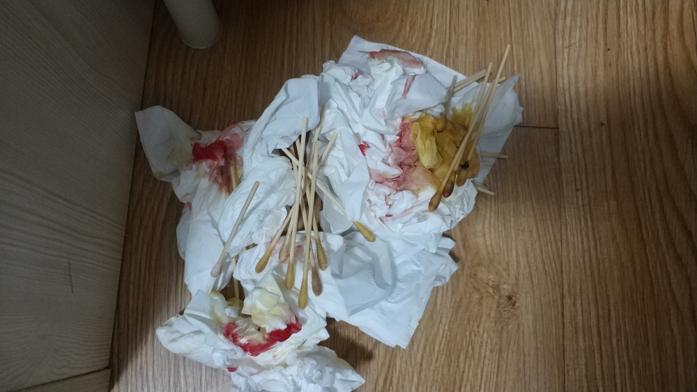 论屁股上长了个火疖子是什么体验下