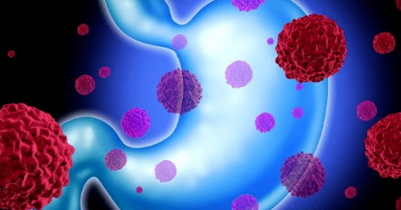 癌症怎么发现 77629356e079369b59b8d92678fbf34430151fd5.png