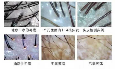 7a2cecd8db4d924e72c3f6a7d05231fec6f92a6a.png