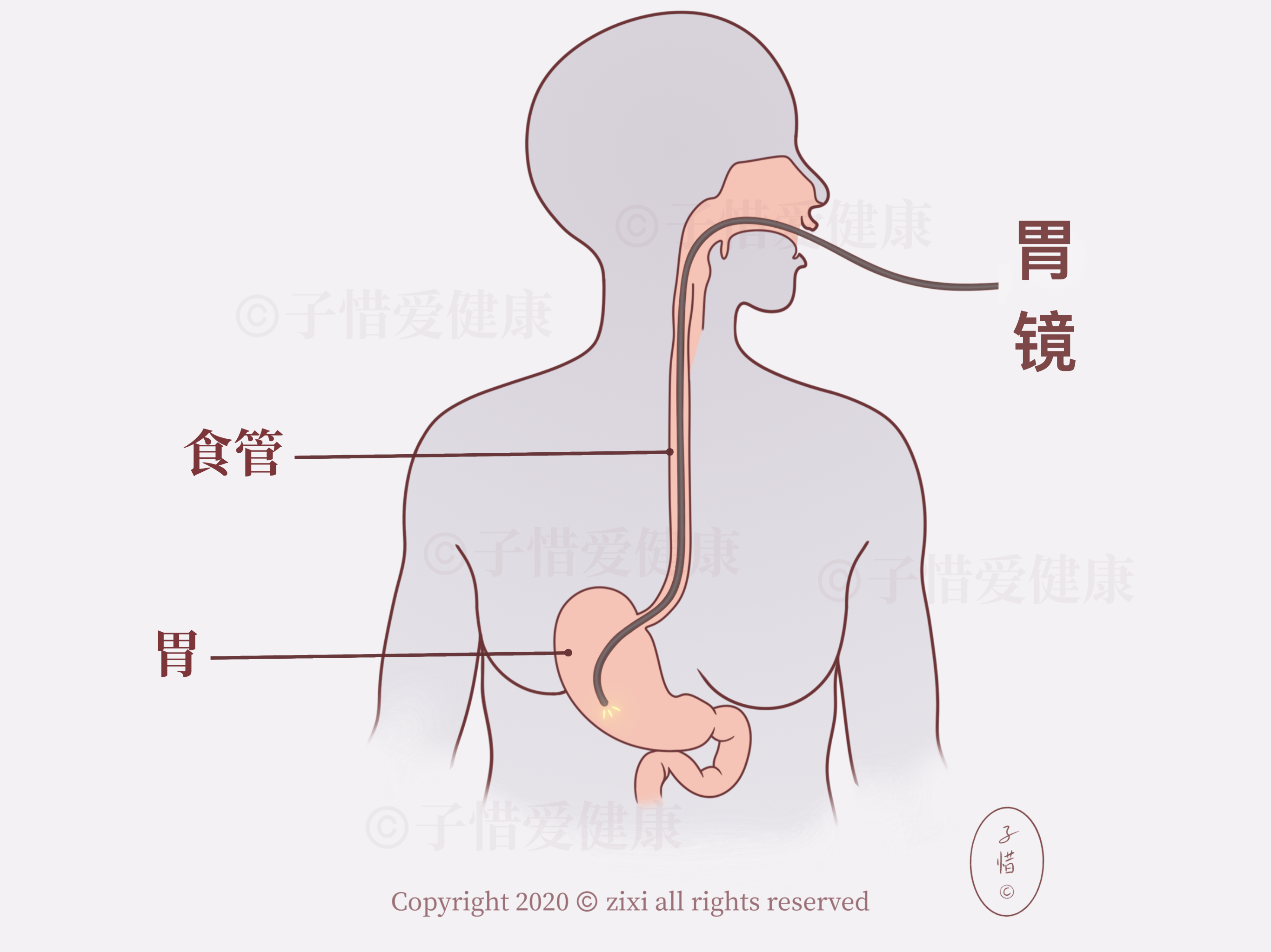 胃镜示意图   自己画的