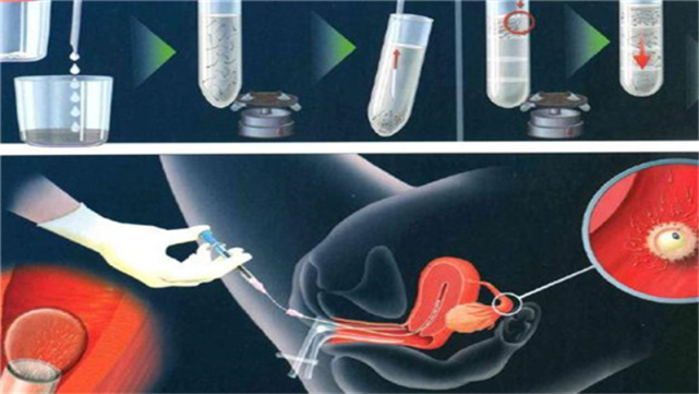 几个月可以药流 7c2248f09e6fb0cf10de58be9b66421bb607f03a.png