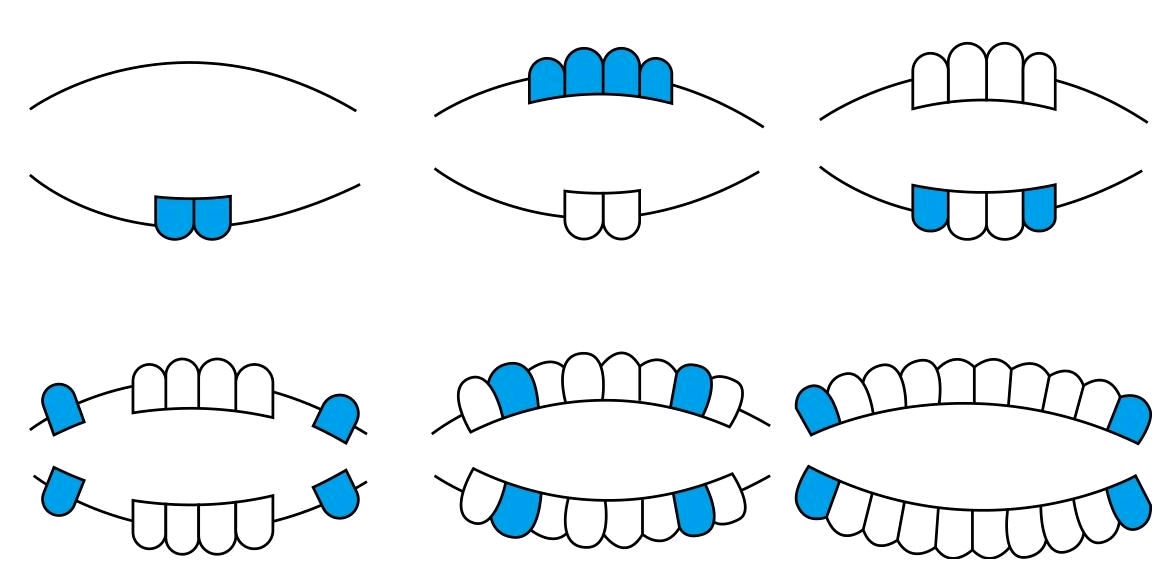 乳牙生长次序图