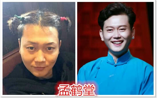 德云社是"整容医院"吗?曾经的杀马特个个都颜值逆袭!