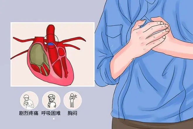心脏病由于冠心病、心力衰竭等心脏疾病，会严重影响患者的心功能，导致