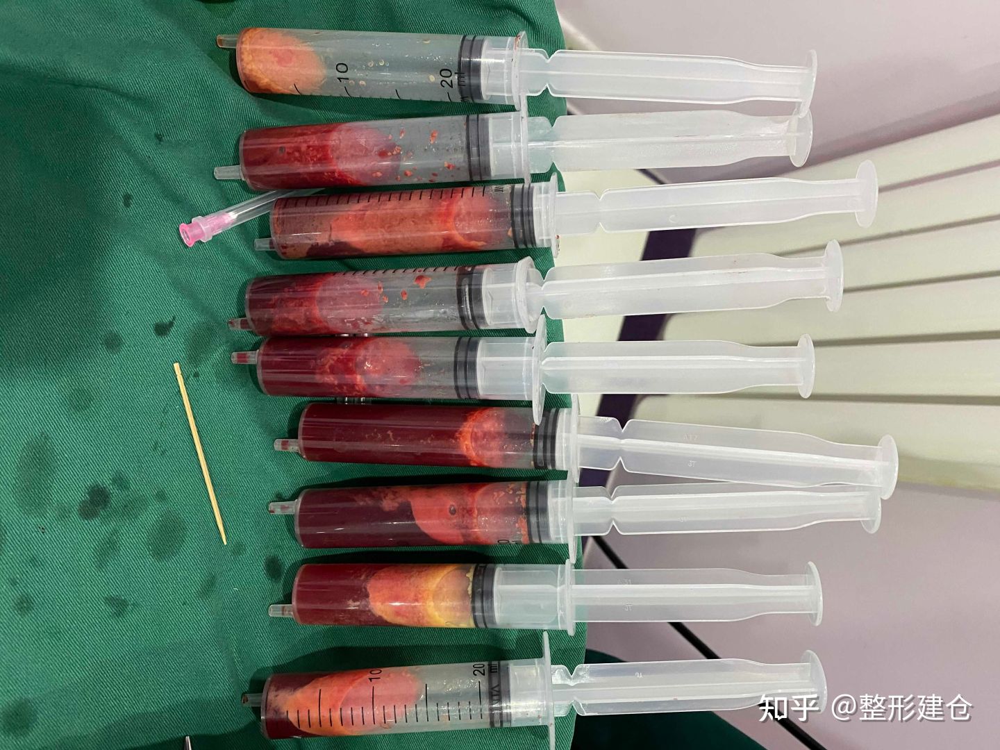 取生长因子,纳米脂肪抽脂,脂肪胶抽脂总说