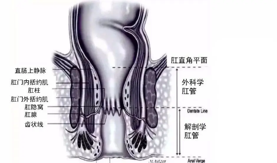 这难治的肛瘘到底是个什么鬼?