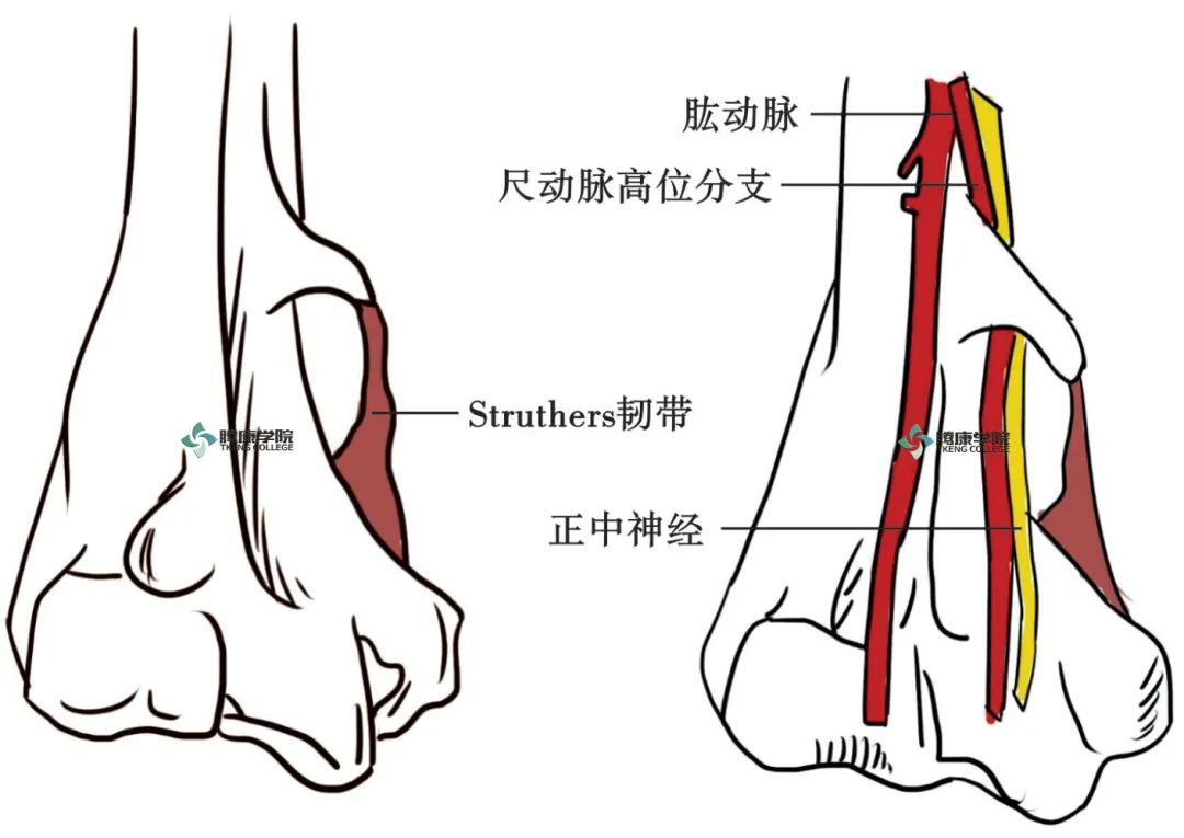 结构(髁上棘),其中2/3 有struthers韧带将肱骨内上髁与髁上棘连接起来