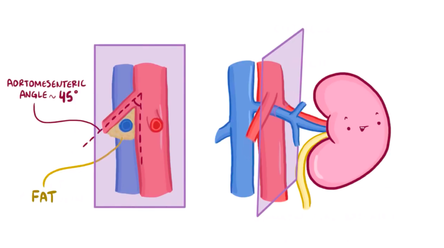 mesenteric,mesenchymal aortomesenteric angle