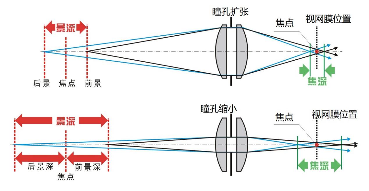 当瞳孔缩小时,虽然焦点也依旧落在视网膜上,但是前景深