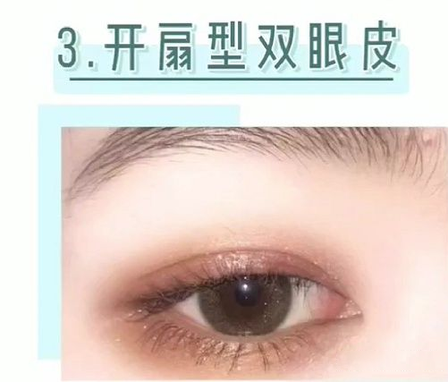 干货科普你该如何选择双眼皮手术全切or埋线