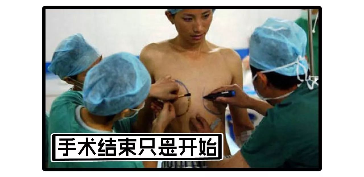 我做变性手术可不是因为什么勇气