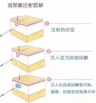 a2a89455395d36d167d074272d4f2e96200ed9d3.jpg