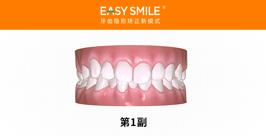 戳～免费预约「3d口扫 预览矫正方案」快速通道