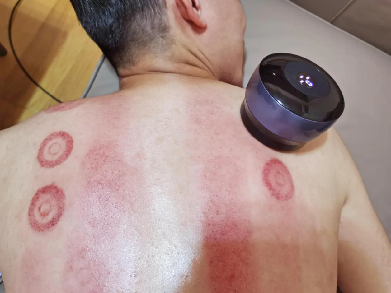 在家自己刮痧拔罐是什么体验？左点智能走罐按摩器测评