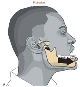 张大嘴巴时下巴会有弹响声颞下颌关节紊乱自我康复流程干货