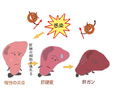 肝癌晚期为何医院不收不收不代表就是没有得治了教你如何延长生命期