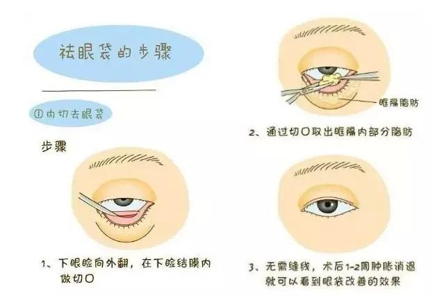 ab3d15f6aa3ed7fd0a6e4f02dc4e78a5db885eb1.jpg