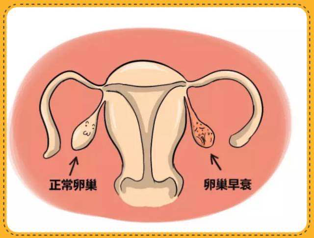 揭秘卵巢早衰的表现如何保养卵巢功能早衰一定要知晓