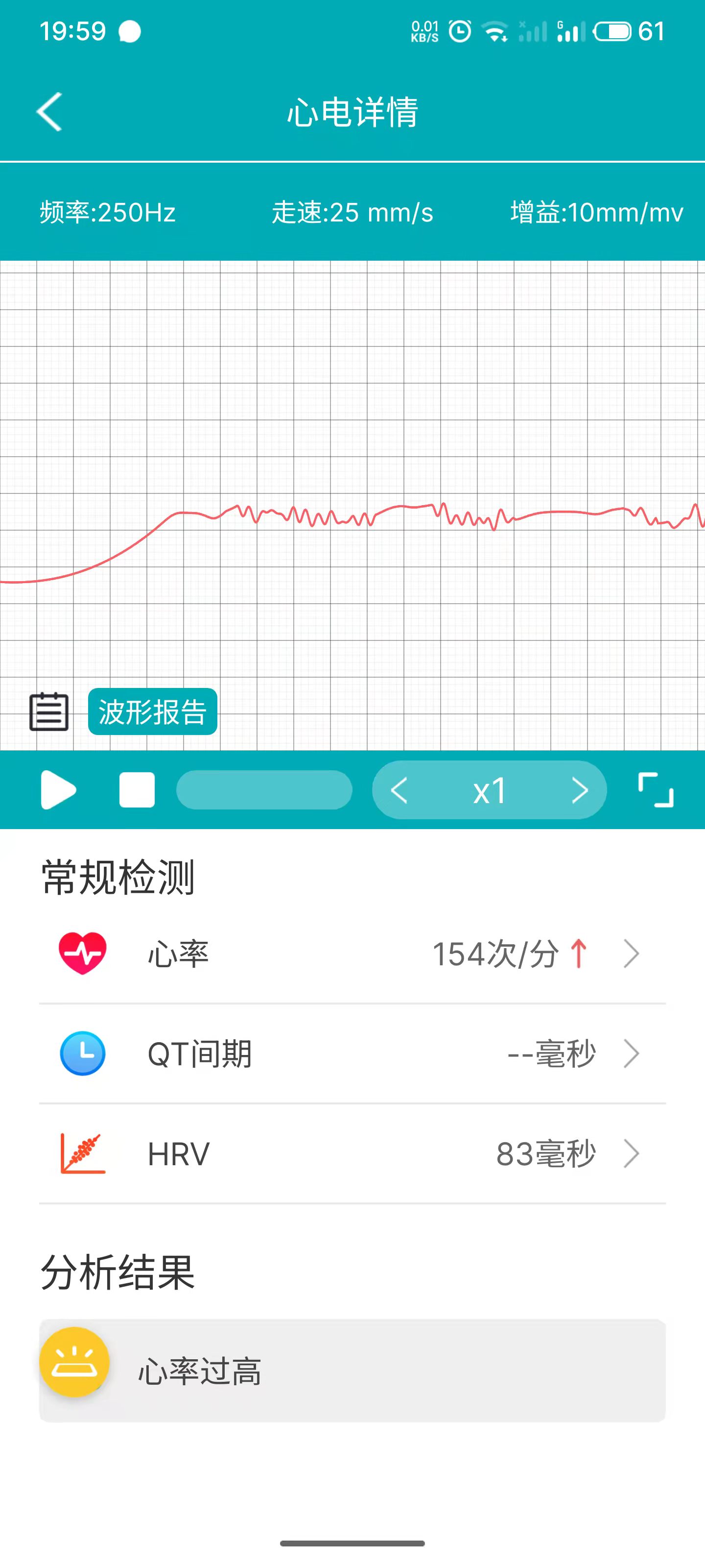 怎么自己测心脏健康 b09b61d46f43ea841bdc6e409a8efd47c2a1b8a7.jpg