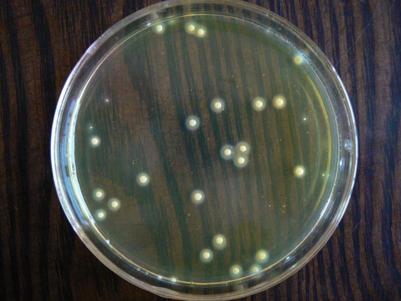 普通培养基(一般生物实验室的肉汤或者是琼脂培养基)上的金黄色葡萄
