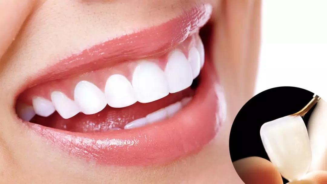 不过与牙冠相比,牙齿贴面对牙齿的损害却小得多.