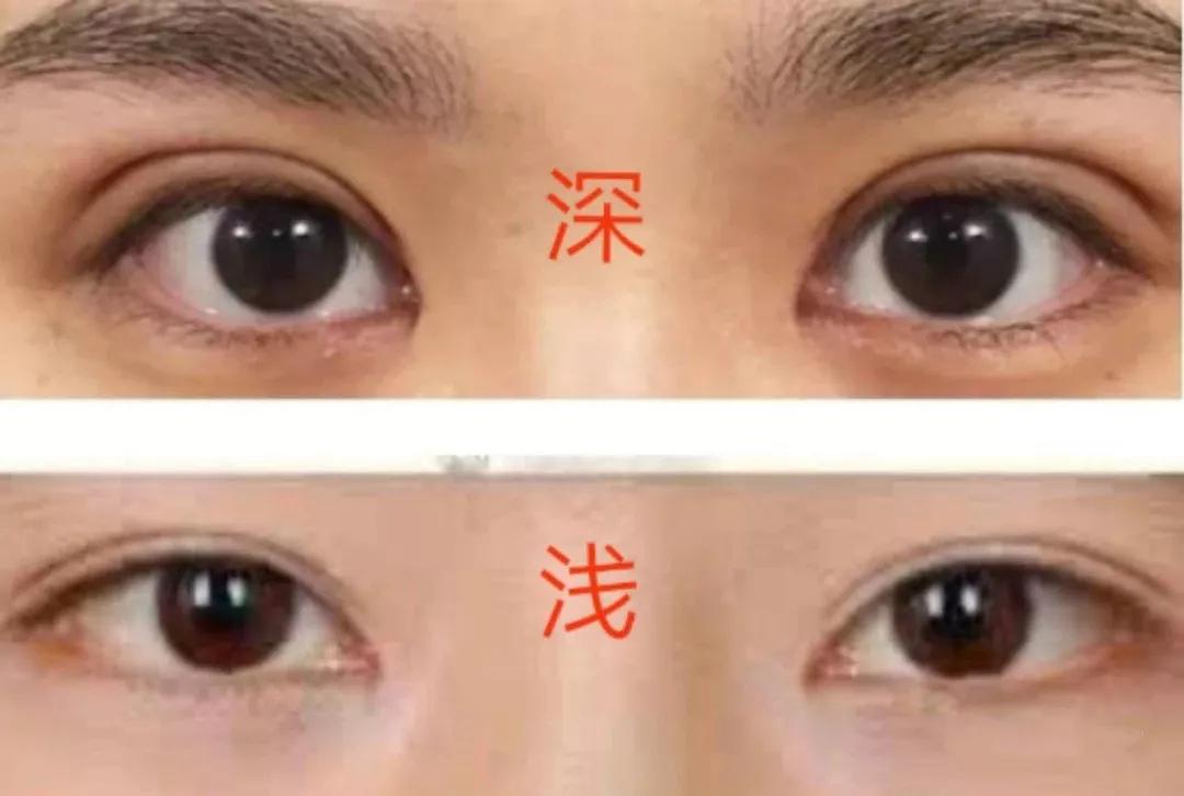 双眼皮深改浅