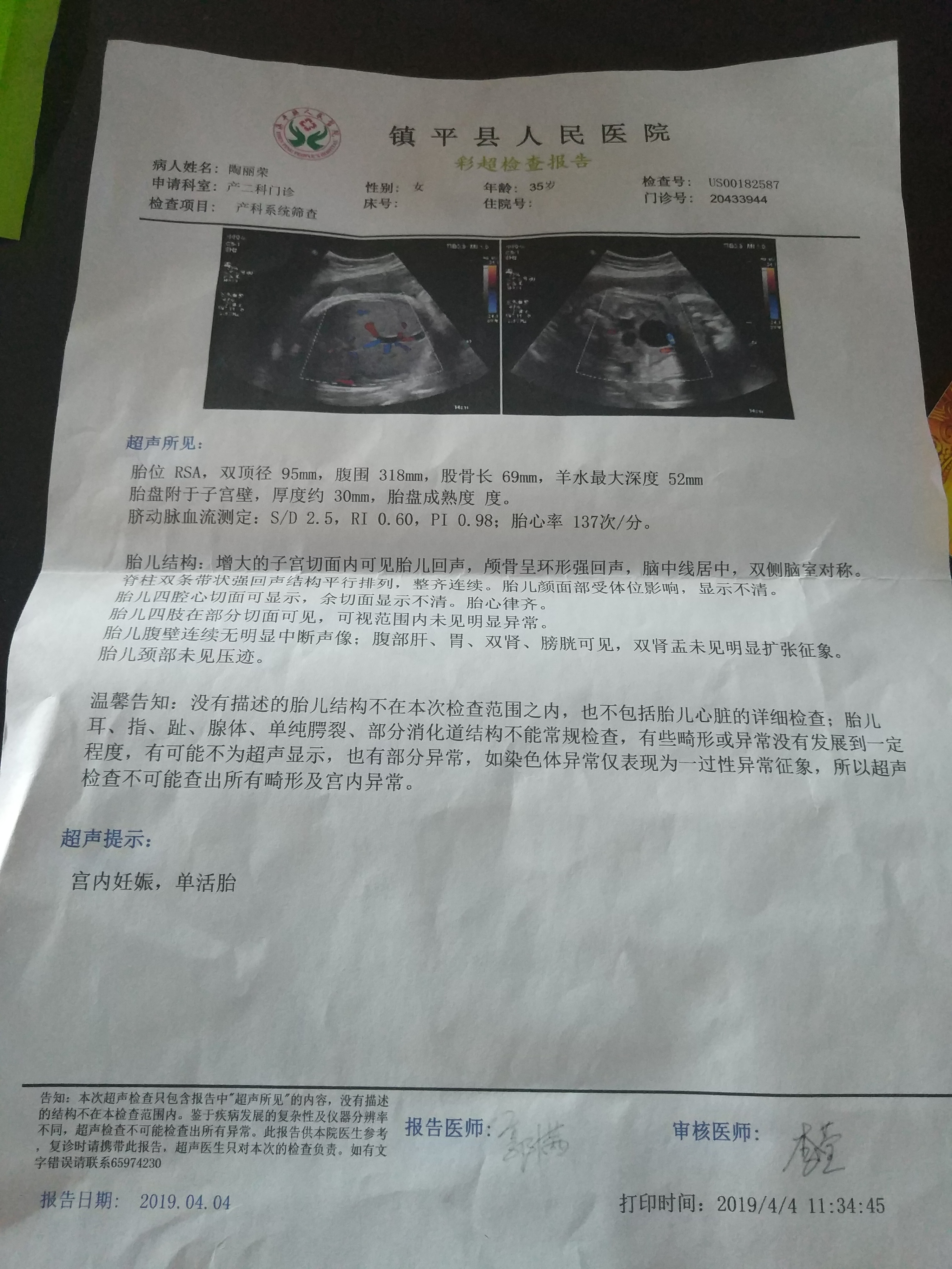 我的血型rh阴性ab型,保胎到预产期,选择的剖腹产,感觉