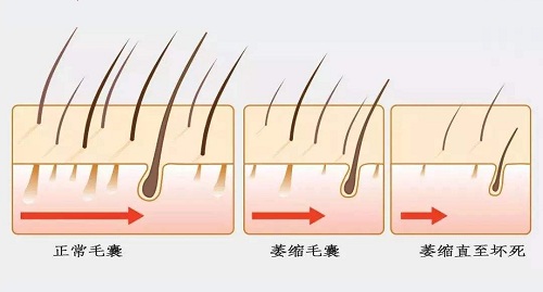 秋季烦恼,头皮敏感干燥怎么办?