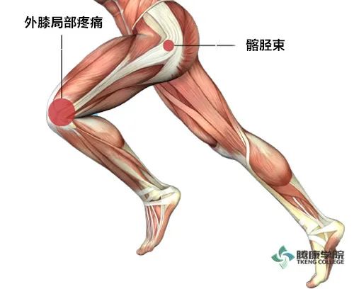 髂胫束摩擦综合征的分析与治疗(it band综合征)