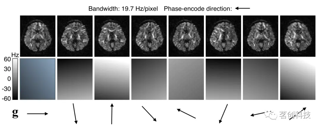 弥散磁共振成像(dmri)伪影校正