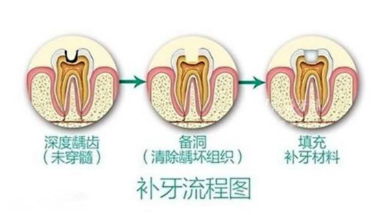 梦见下排牙齿都碎了，一场潜意识的警示与自我疗愈之旅