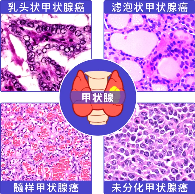 ca61767fc11467c7e7e55b10fc16b2583546384623995725.png