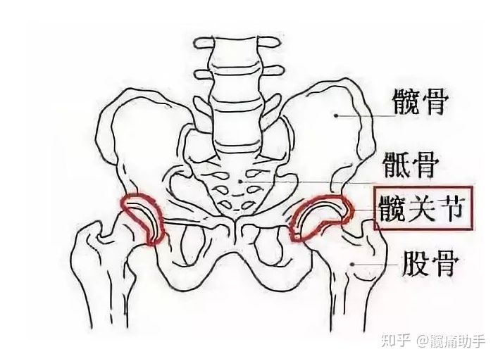 髋关节撞击症丨没听说过?你可能已经深受其害|髋痛助手