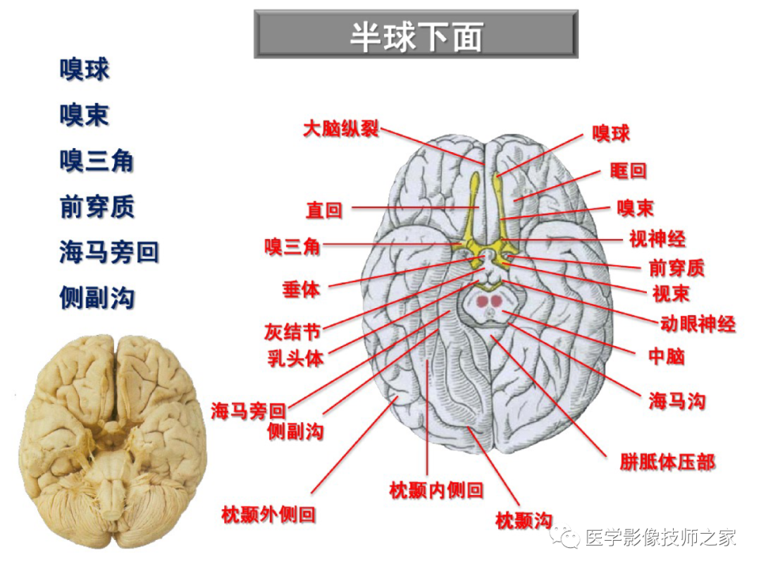 中枢神经系统功能解剖及定位