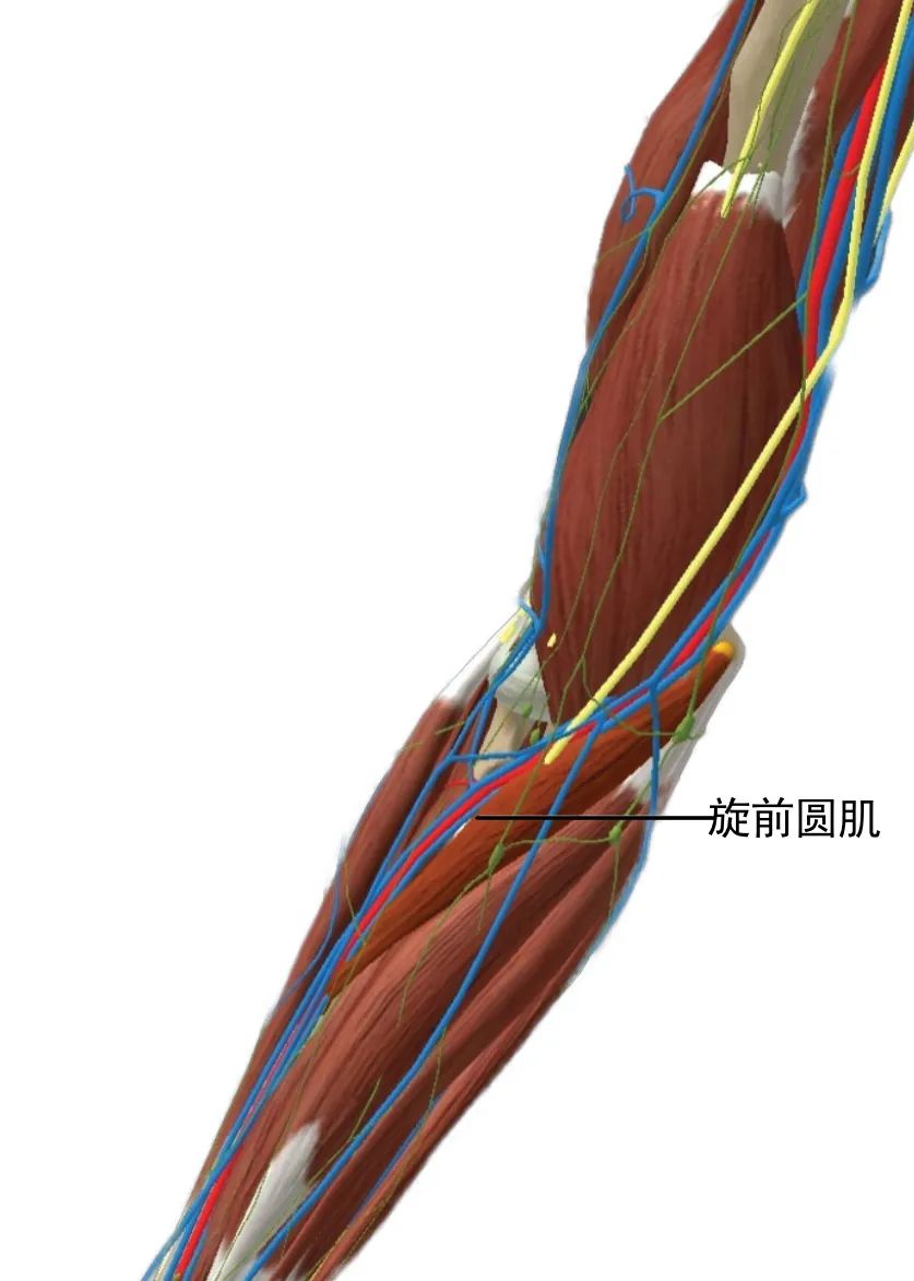 正中神经可能在其穿过旋前圆肌两个头的部位受到挤压或压迫.