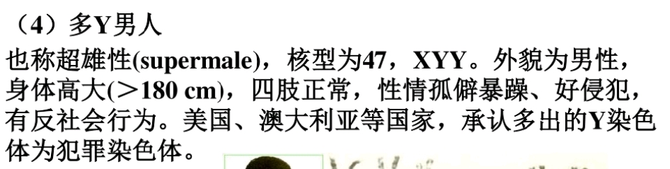 xyy综合征