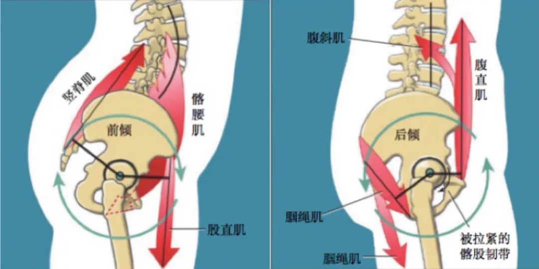 修复髋屈肌群:实现无痛奔跑和深蹲