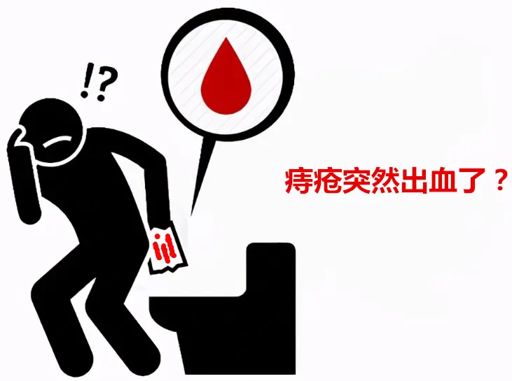 痔疮突然出血，如何进行处理?
