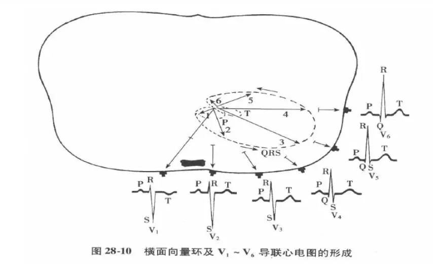 解释诊断489页 左心室肥厚，左前分支阻滞导致心电轴左偏