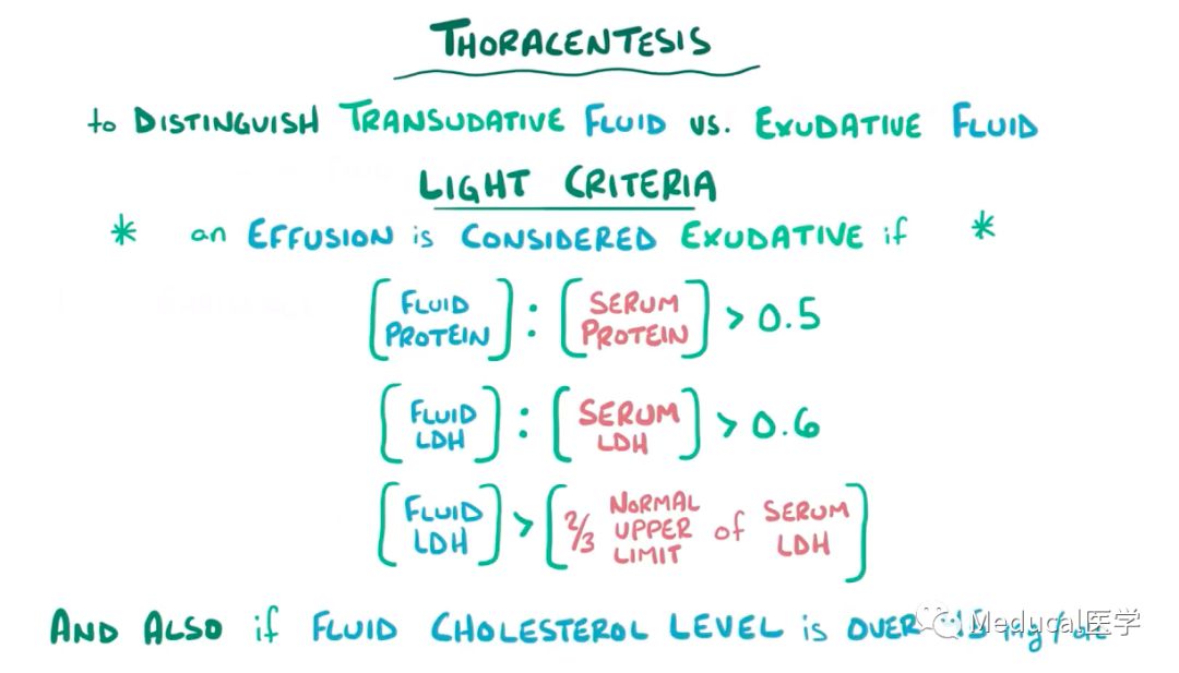 the biggest challenge is distinguishing between a  transudative