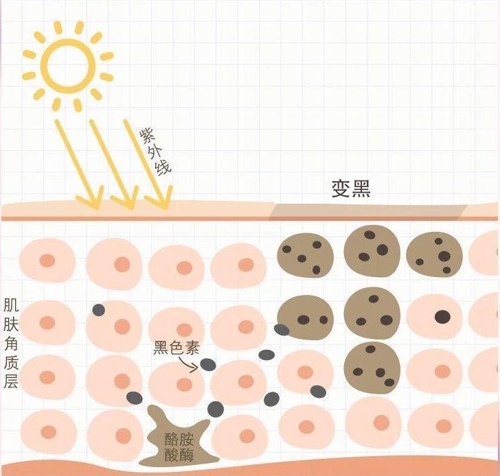 ▌想要变白,首先需要知道,皮肤为什么会变黑?